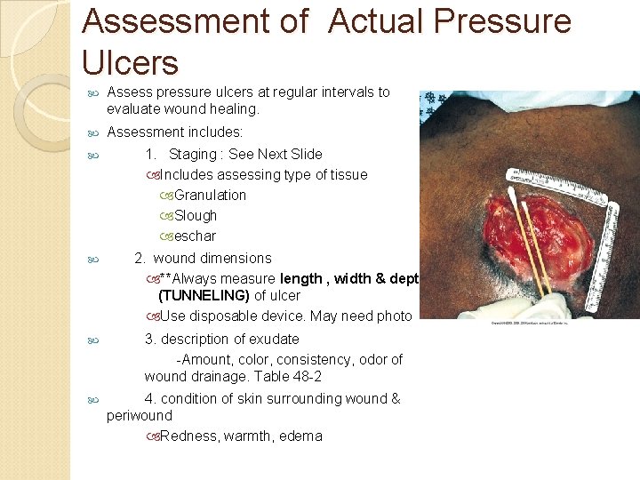 Assessment of Actual Pressure Ulcers Assess pressure ulcers at regular intervals to evaluate wound