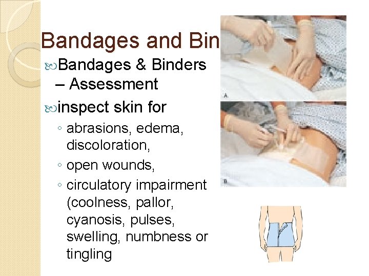 Bandages and Binders Bandages & Binders – Assessment inspect skin for ◦ abrasions, edema,