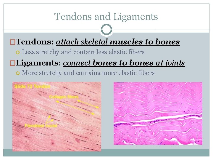 Tendons and Ligaments �Tendons: attach skeletal muscles to bones Less stretchy and contain less