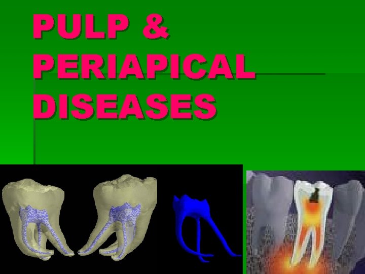 PULP & PERIAPICAL DISEASES 