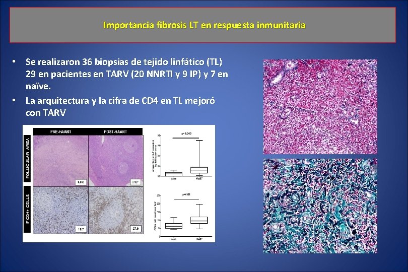 Importancia fibrosis LT en respuesta inmunitaria • Se realizaron 36 biopsias de tejido linfático