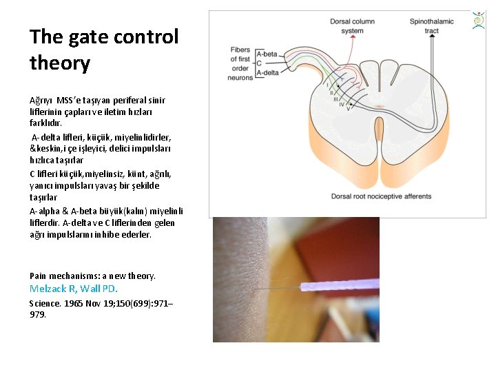 The gate control theory Ağrıyı MSS’e taşıyan periferal sinir liflerinin çapları ve iletim hızları