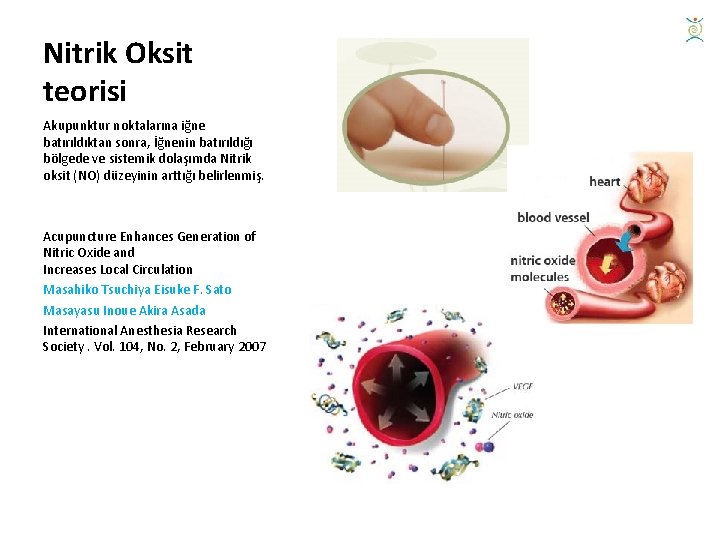 Nitrik Oksit teorisi Akupunktur noktalarına iğne batırıldıktan sonra, İğnenin batırıldığı bölgede ve sistemik dolaşımda