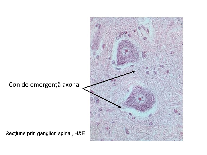 Con de emergenţă axonal Secţiune prin ganglion spinal, H&E 