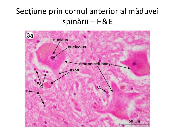 Secţiune prin cornul anterior al măduvei spinării – H&E 