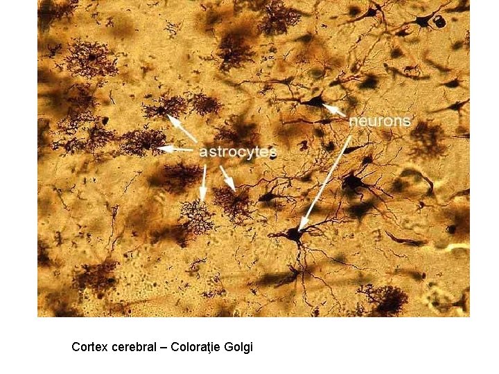 Cortex cerebral – Coloraţie Golgi 