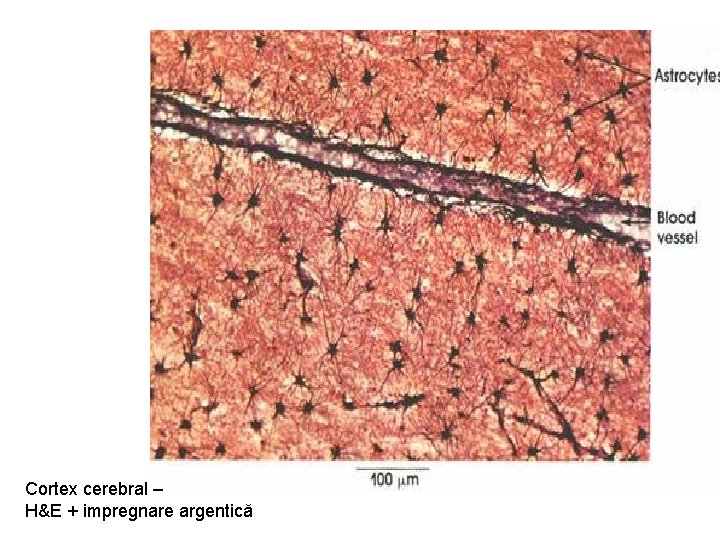 Cortex cerebral – H&E + impregnare argentică 