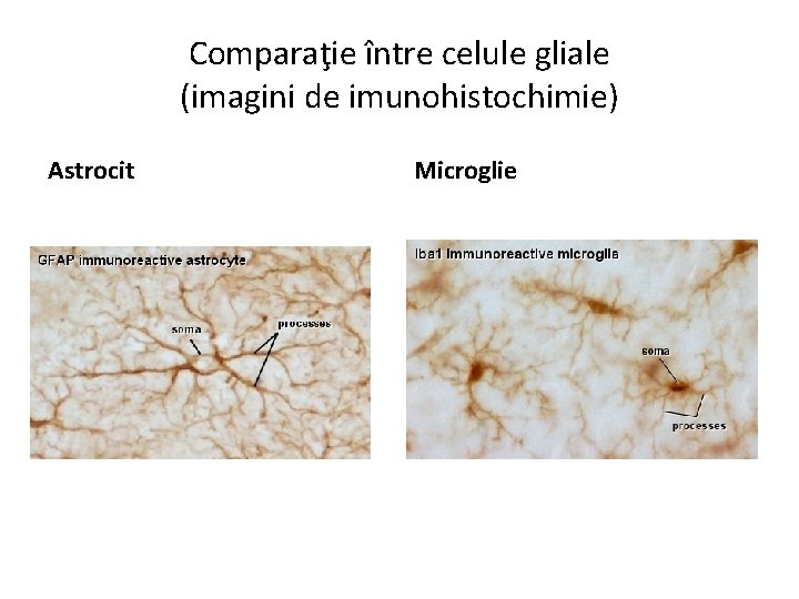 Comparaţie între celule gliale (imagini de imunohistochimie) Astrocit Microglie 