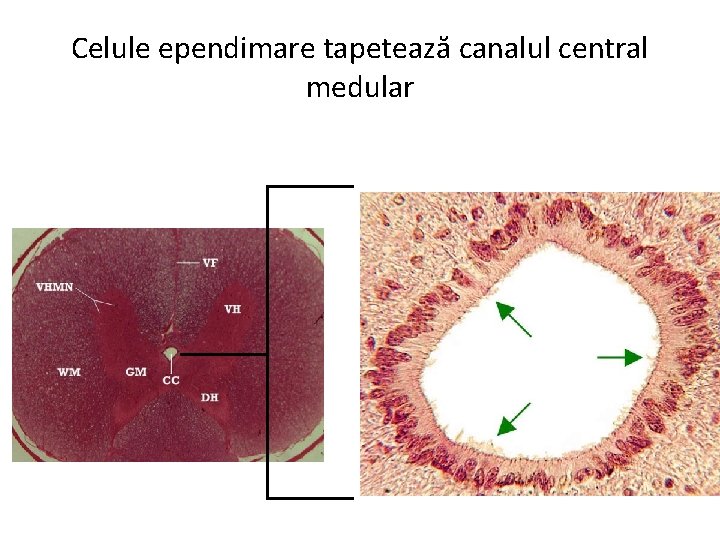 Celule ependimare tapetează canalul central medular 