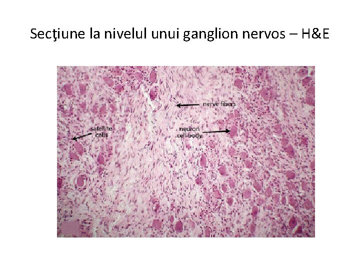 Secţiune la nivelul unui ganglion nervos – H&E 