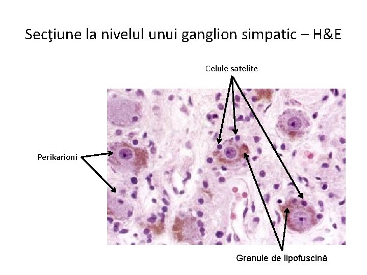 Secţiune la nivelul unui ganglion simpatic – H&E Celule satelite Perikarioni Granule de lipofuscină