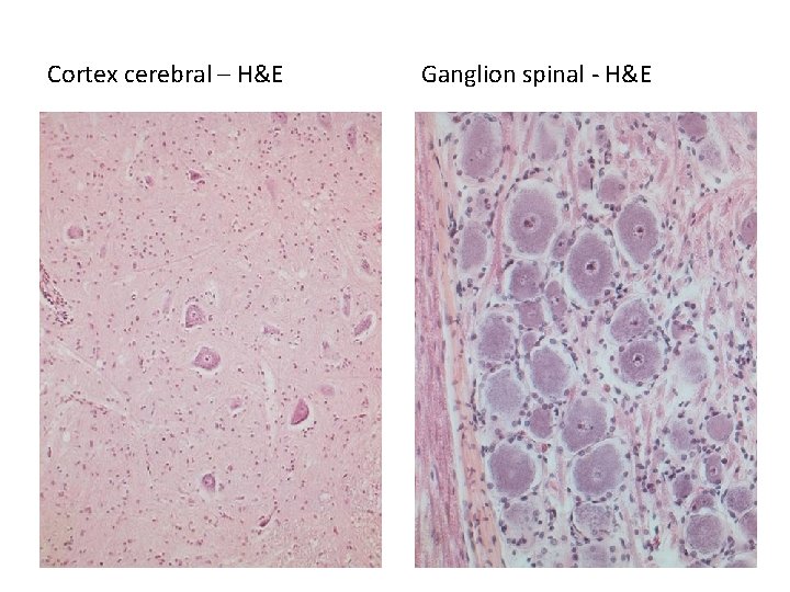 Cortex cerebral – H&E Ganglion spinal - H&E 