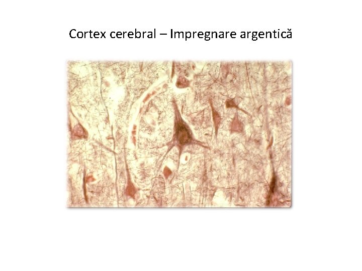 Cortex cerebral – Impregnare argentică 