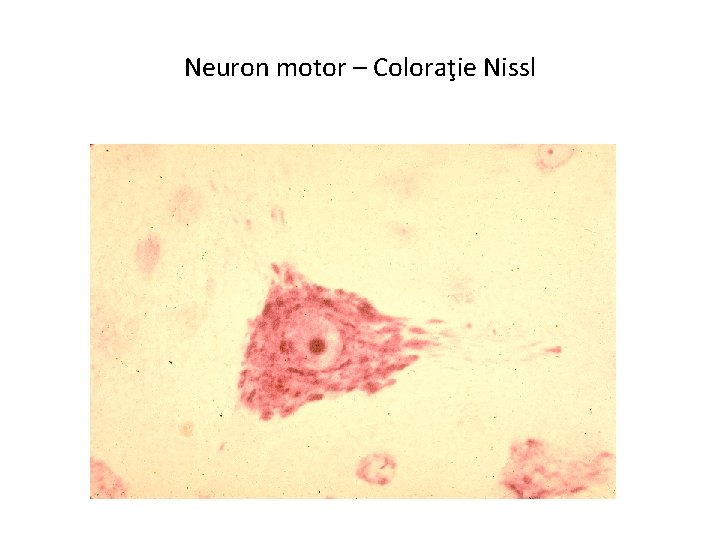 Neuron motor – Coloraţie Nissl 