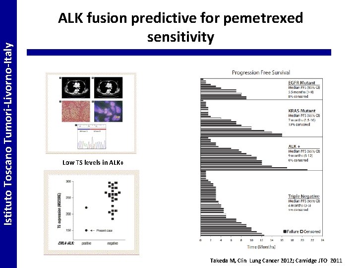 Istituto Toscano Tumori-Livorno-Italy ALK fusion predictive for pemetrexed sensitivity Low TS levels in ALK+