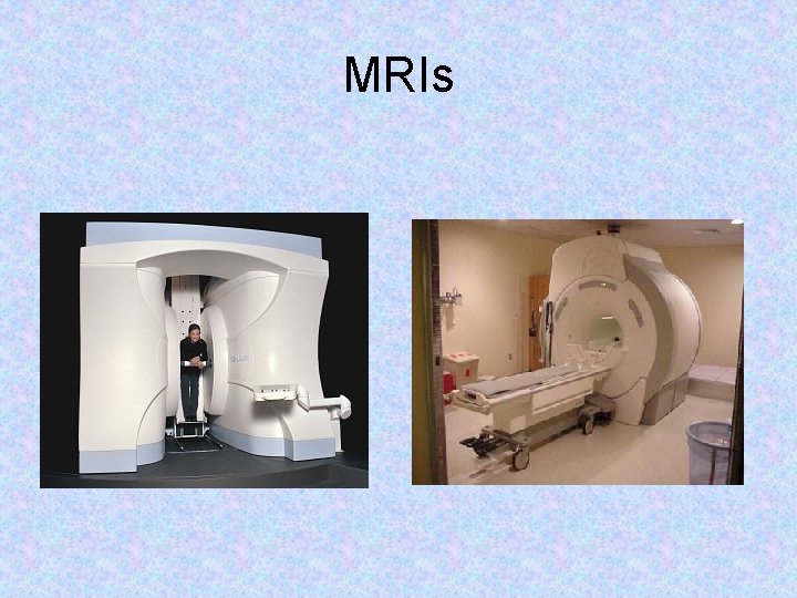 MRIs 