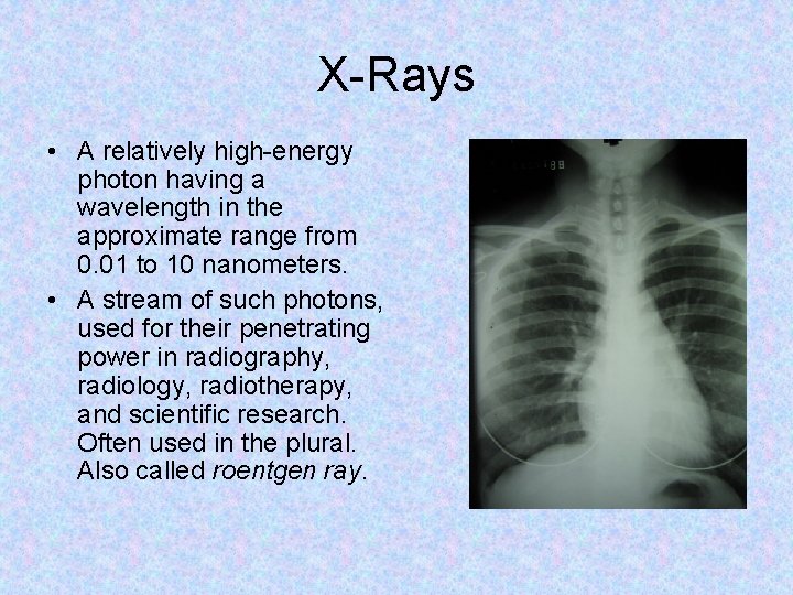 X-Rays • A relatively high-energy photon having a wavelength in the approximate range from