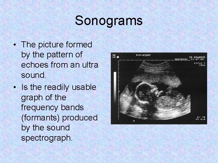 Sonograms • The picture formed by the pattern of echoes from an ultra sound.