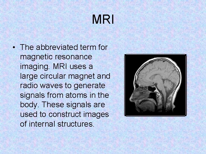 MRI • The abbreviated term for magnetic resonance imaging. MRI uses a large circular