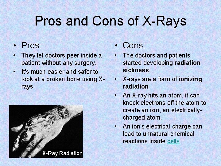 Pros and Cons of X-Rays • Pros: • Cons: • They let doctors peer