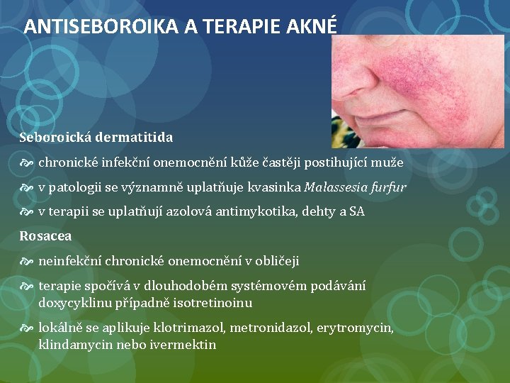 ANTISEBOROIKA A TERAPIE AKNÉ Seboroická dermatitida chronické infekční onemocnění kůže častěji postihující muže v