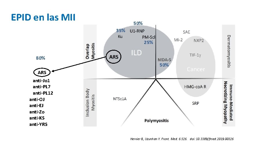 EPID en las MII 50% 35% 25% 80% 50% ARS anti-Jo 1 anti-PL 7