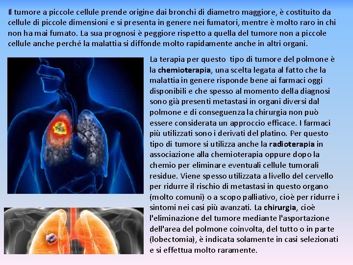 Il tumore a piccole cellule prende origine dai bronchi di diametro maggiore, è costituito