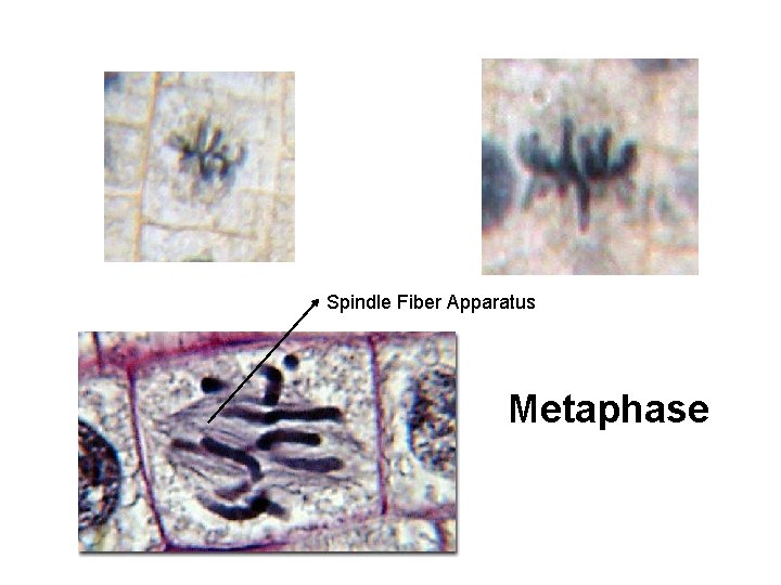 Spindle Fiber Apparatus Metaphase 