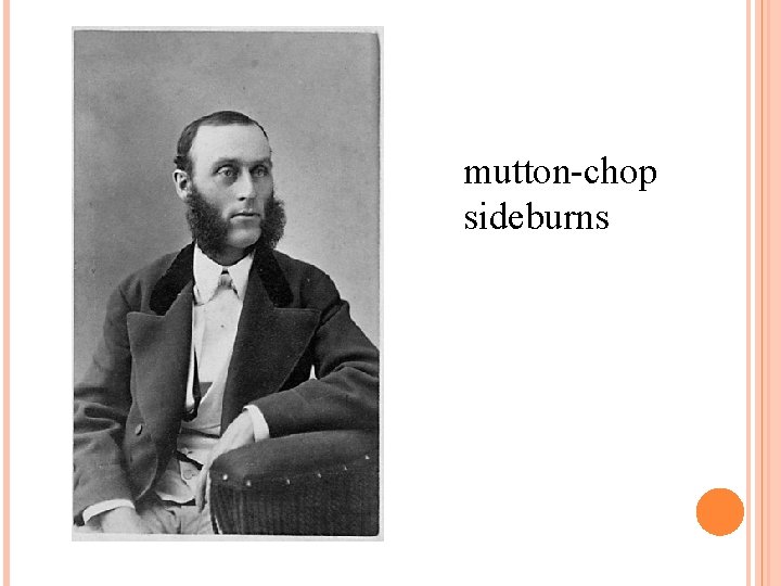 mutton-chop sideburns 