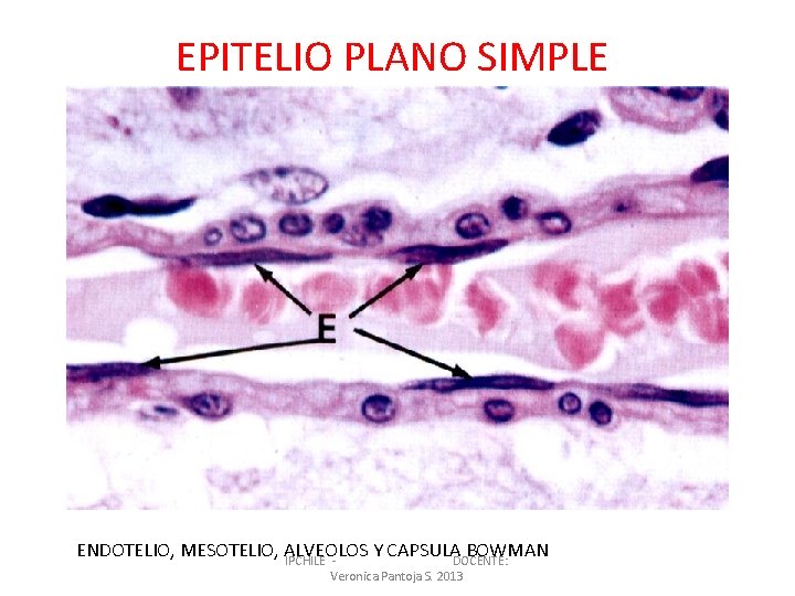 EPITELIO PLANO SIMPLE ENDOTELIO, MESOTELIO, ALVEOLOS Y CAPSULADOCENTE: BOWMAN IPCHILE Veronica Pantoja S. 2013
