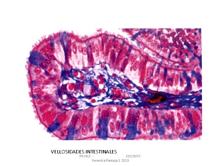 VELLOSIDADES INTESTINALES IPCHILE DOCENTE: Veronica Pantoja S. 2013 