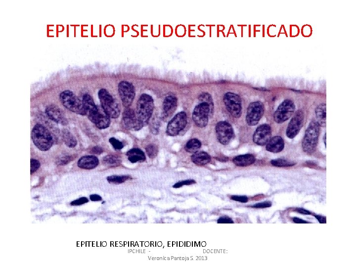 EPITELIO PSEUDOESTRATIFICADO EPITELIO RESPIRATORIO, EPIDIDIMO IPCHILE DOCENTE: Veronica Pantoja S. 2013 