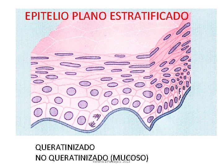 EPITELIO PLANO ESTRATIFICADO QUERATINIZADO IPCHILE DOCENTE: NO QUERATINIZADO (MUCOSO) Veronica Pantoja S. 2013 