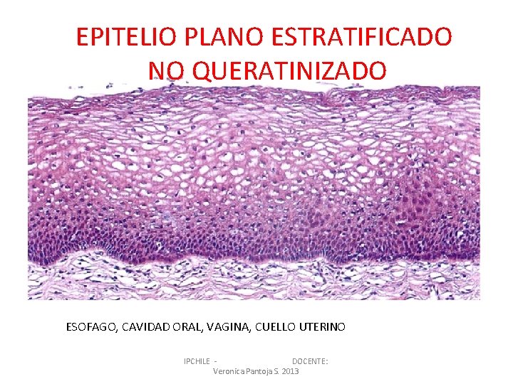 EPITELIO PLANO ESTRATIFICADO NO QUERATINIZADO ESOFAGO, CAVIDAD ORAL, VAGINA, CUELLO UTERINO IPCHILE DOCENTE: Veronica