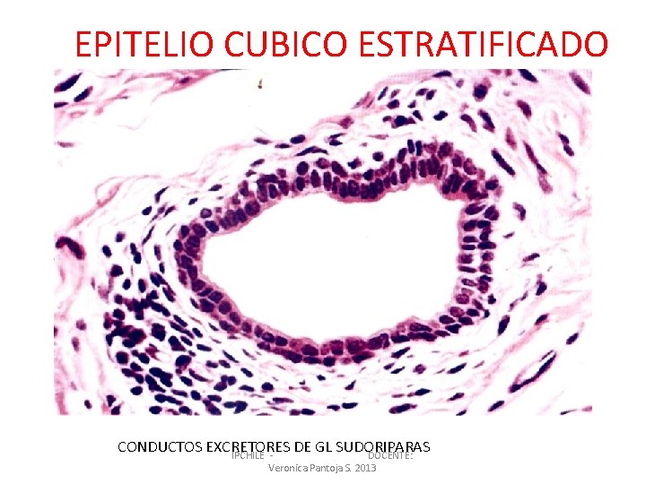 EPITELIO CUBICO ESTRATIFICADO CONDUCTOS EXCRETORES DE GL SUDORIPARAS IPCHILE DOCENTE: Veronica Pantoja S. 2013
