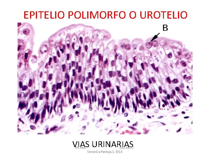 EPITELIO POLIMORFO O UROTELIO VIAS URINARIAS IPCHILE DOCENTE: Veronica Pantoja S. 2013 