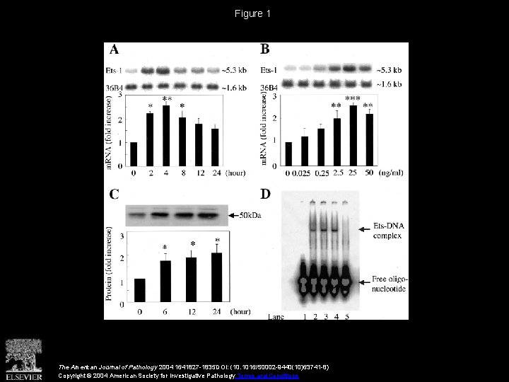 Figure 1 The American Journal of Pathology 2004 1641827 -1835 DOI: (10. 1016/S 0002