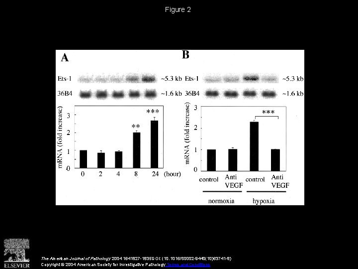 Figure 2 The American Journal of Pathology 2004 1641827 -1835 DOI: (10. 1016/S 0002 Figure 2 The American Journal of Pathology 2004 1641827 -1835 DOI: (10. 1016/S 0002