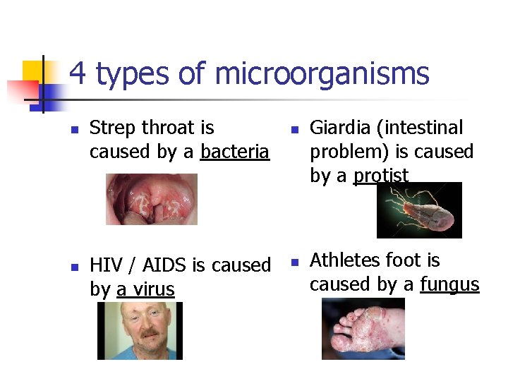 4 types of microorganisms n n Strep throat is caused by a bacteria HIV