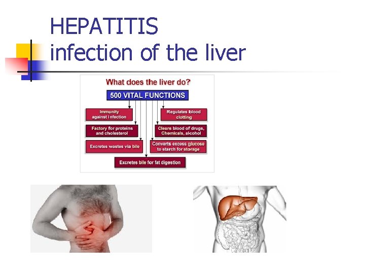 HEPATITIS infection of the liver 