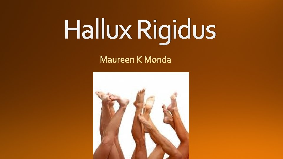 Hallux Rigidus 