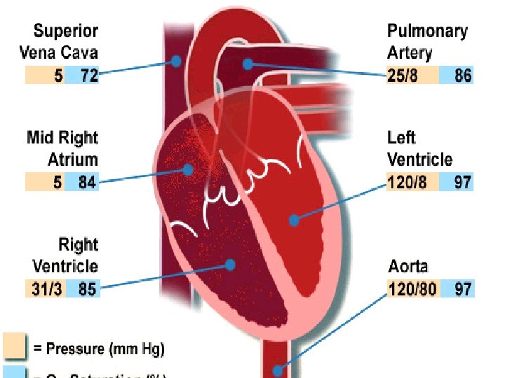 ESTUDO HEMODIN MICO • • Indefinição dos defeitos Doenças associadas Localização de veias pulmonares