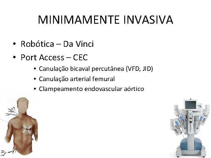 MINIMAMENTE INVASIVA • Robótica – Da Vinci • Port Access – CEC • Canulação