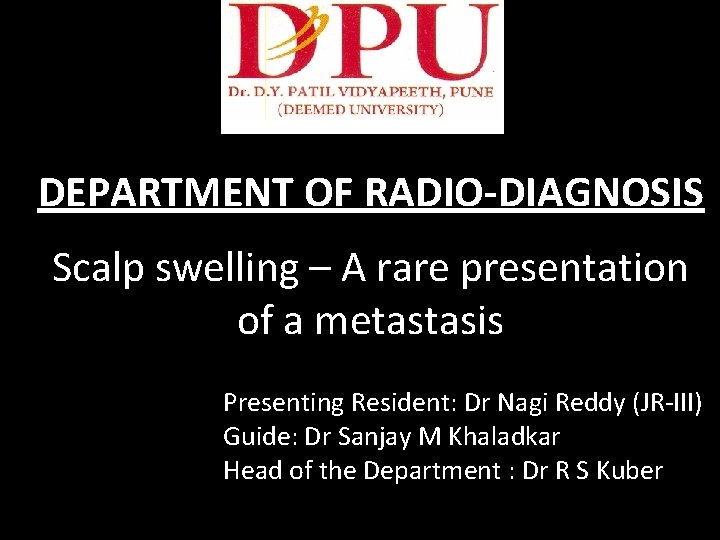 DEPARTMENT OF RADIO-DIAGNOSIS Scalp swelling – A rare presentation of a metastasis Presenting Resident: