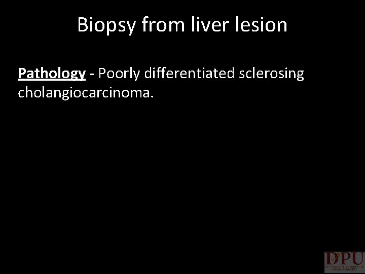 Biopsy from liver lesion Pathology - Poorly differentiated sclerosing cholangiocarcinoma. 