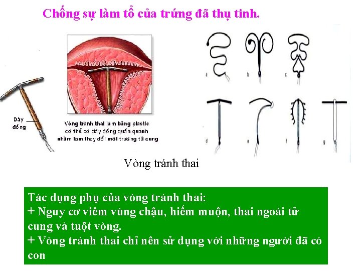 Chống sự làm tổ của trứng đã thụ tinh. Vòng tránh thai Tác dụng