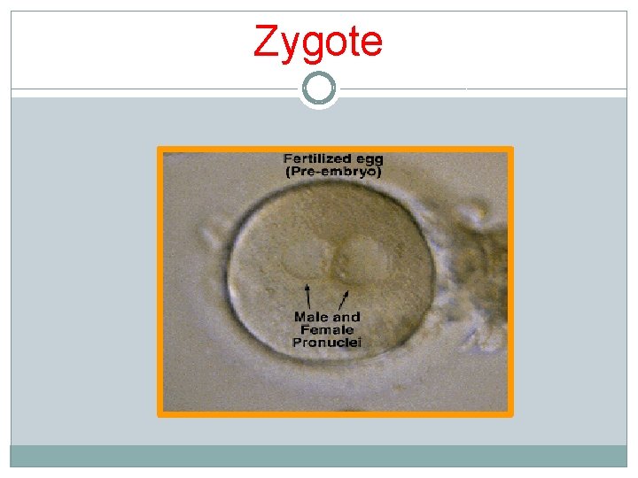 Zygote Zygote