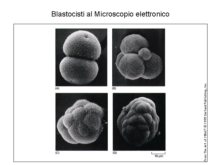 Blastocisti al Microscopio elettronico 