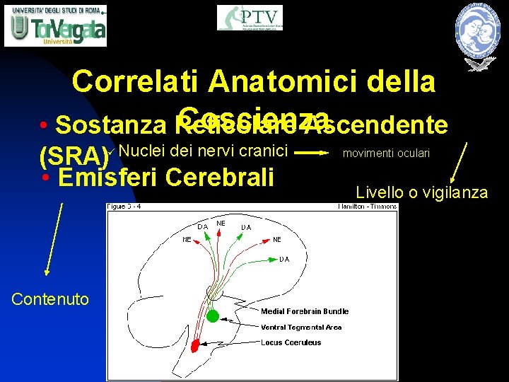 Correlati Anatomici della Coscienza • Sostanza Reticolare Ascendente (SRA)ü Nuclei dei nervi cranici •