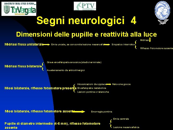 Segni neurologici 4 Dimensioni delle pupille e reattività alla luce Midriasi fissa unilaterale {